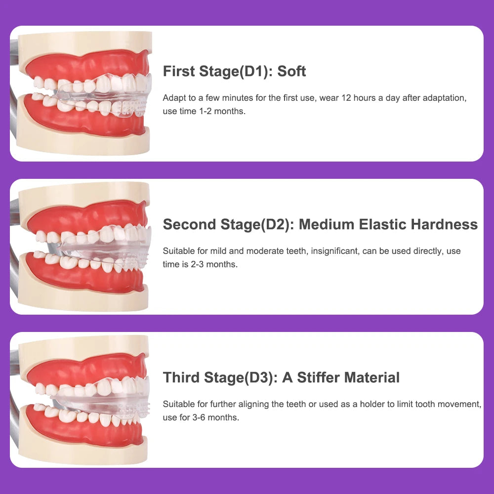 Dental Appliance Tooth Orthodontic Braces Trainer Dental Braces Teeth Trainer Alignment Braces Mouthpiece For Adults Orthodontic