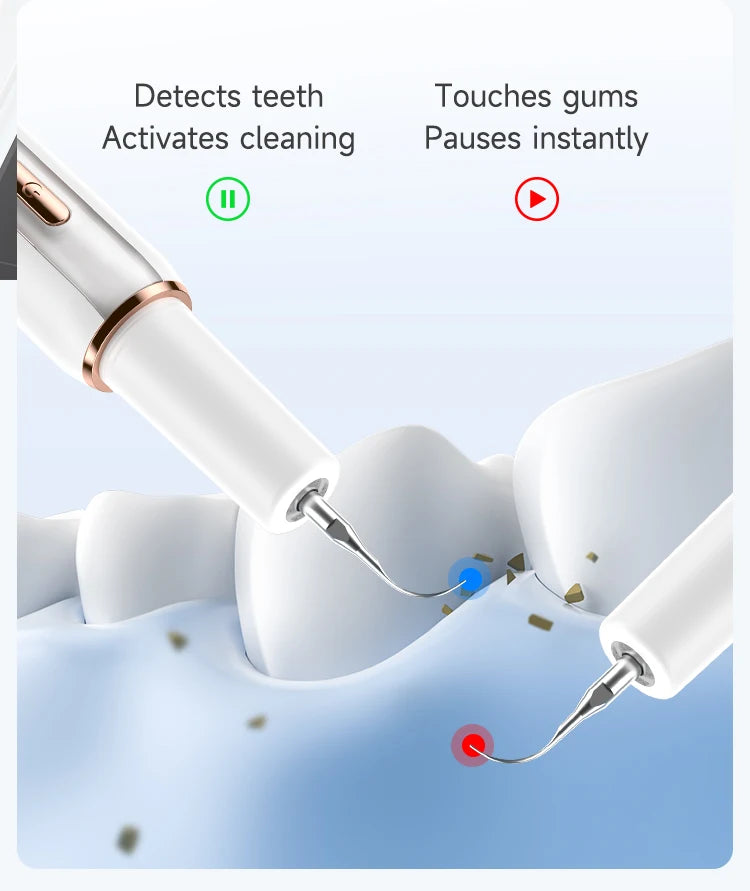 Electric Ultrasonic Dental Cleaner — 5-Mode Calculus & Tartar Remover, Teeth Whitening Oral Care