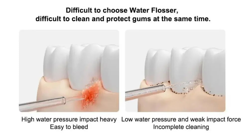 2025 New MIJIA Portable Oral Irrigator 2 Dental Teeth Whitening Flosser bucal tooth Cleaner vibration waterpulse Water Thread