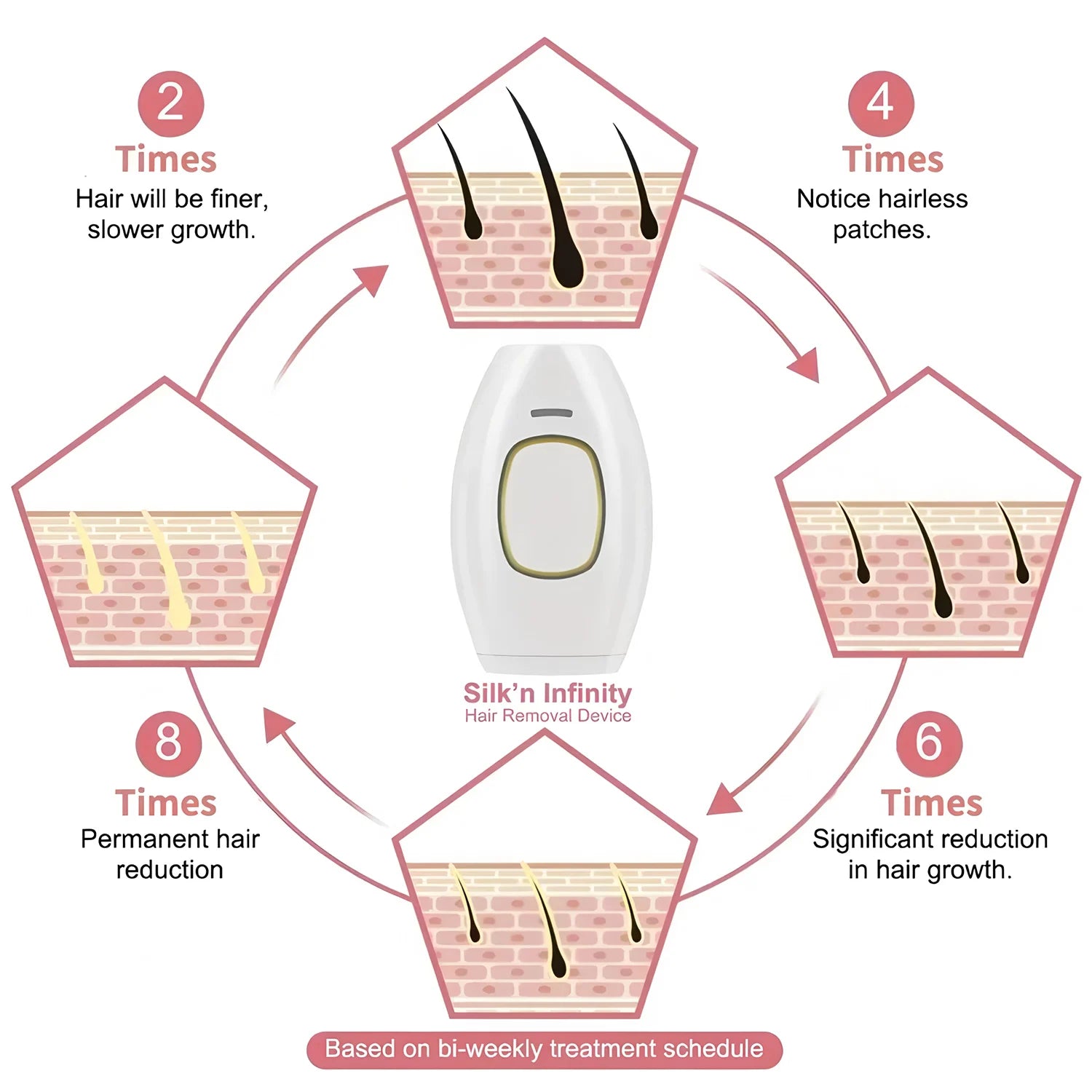 IPL Laser Hair Removal Handset — Painless Electric Depilator for Women & Men at Home