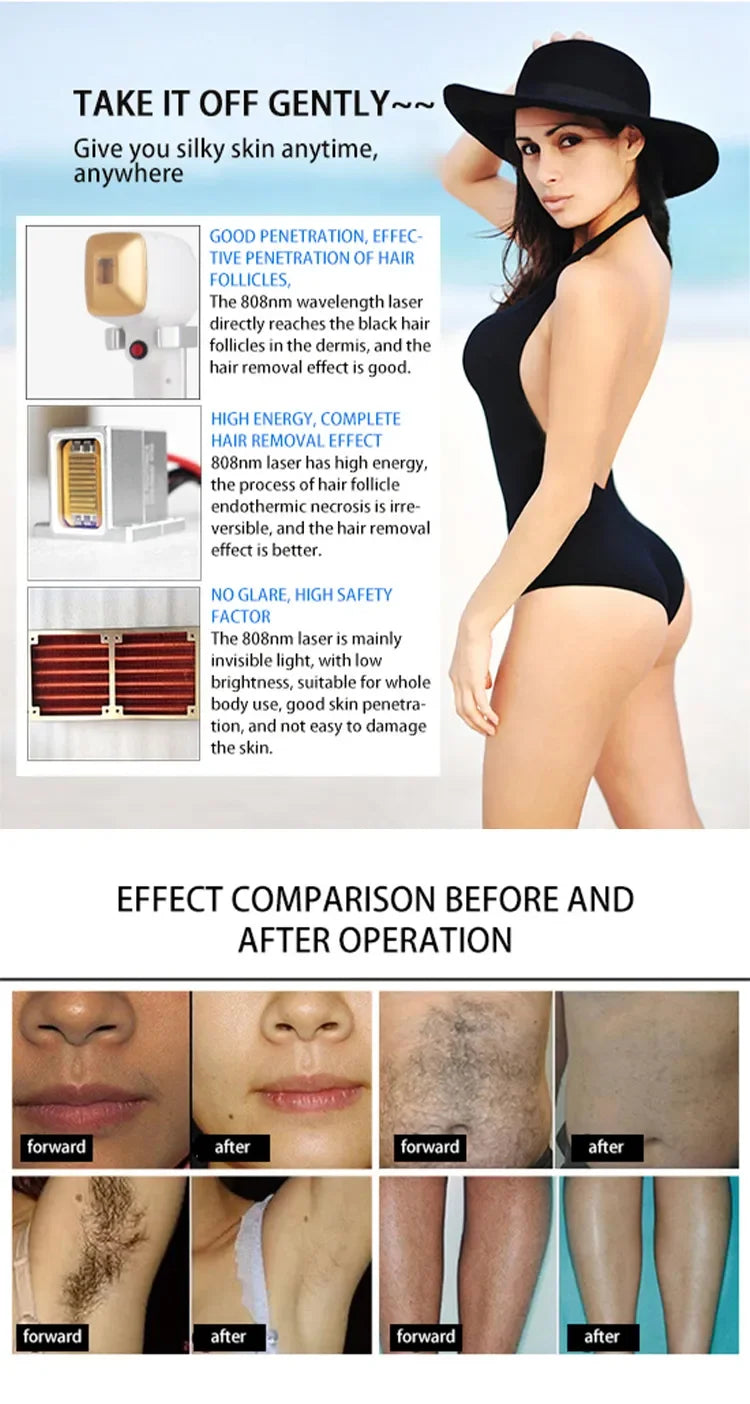Portable Soprano 3000W Professional Diode Laser Hair Removal Machine