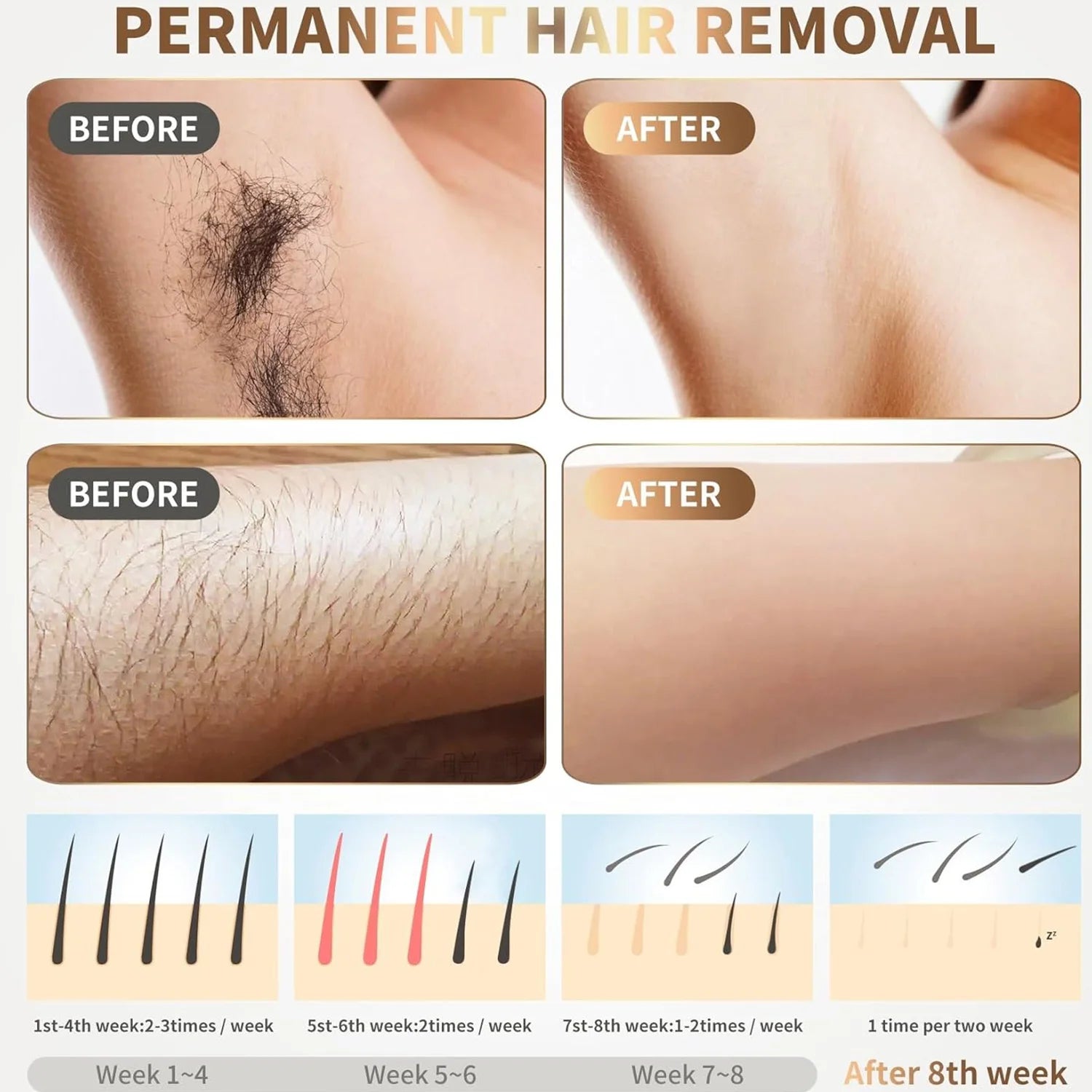 IPL Laser Hair Removal Handset — Painless Electric Depilator for Women & Men at Home