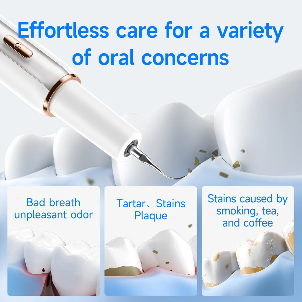 Electric Ultrasonic Dental Cleaner — 5-Mode Calculus & Tartar Remover, Teeth Whitening Oral Care