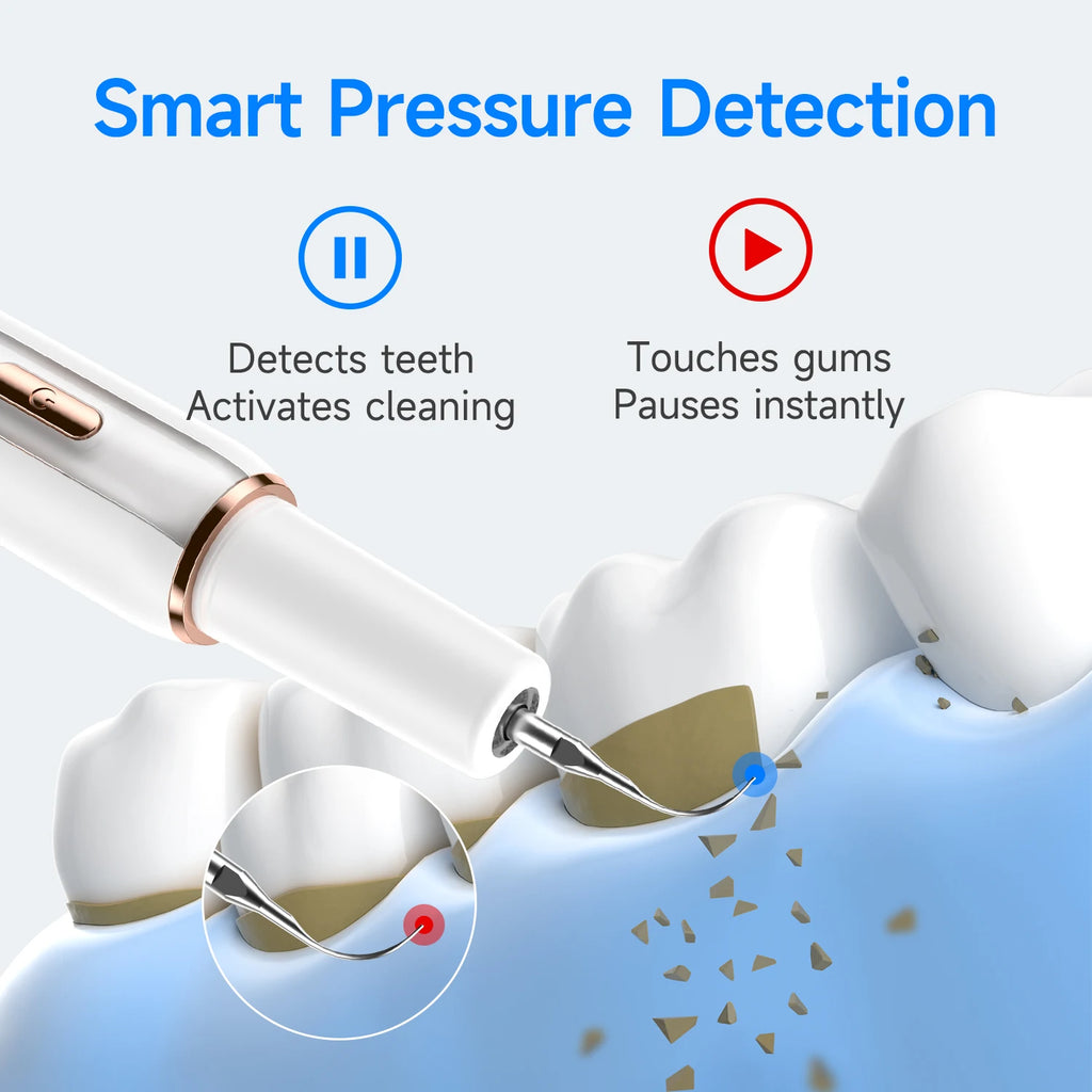 Electric Ultrasonic Dental Cleaner — 5-Mode Calculus & Tartar Remover, Teeth Whitening Oral Care
