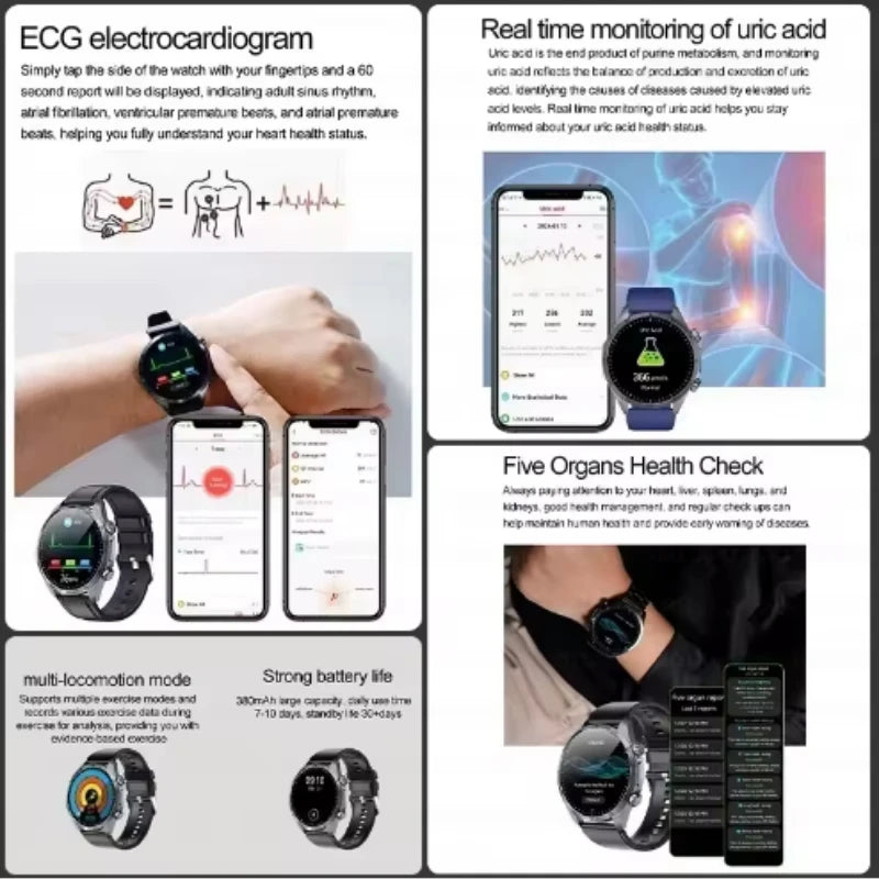 2026 Medical Grade Electropathy Smartwatch — ECG+PPG Blood Sugar, Lipid & Uric Acid
